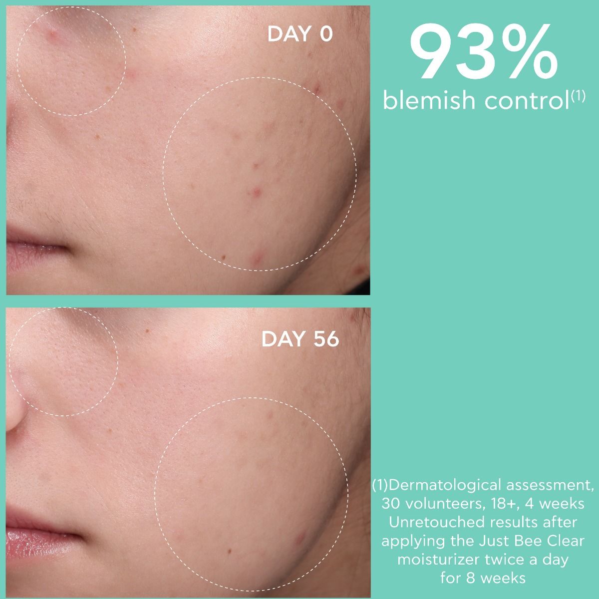Blemish Control Mattifying Moisturizer