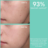 Blemish Control Mattifying Moisturizer