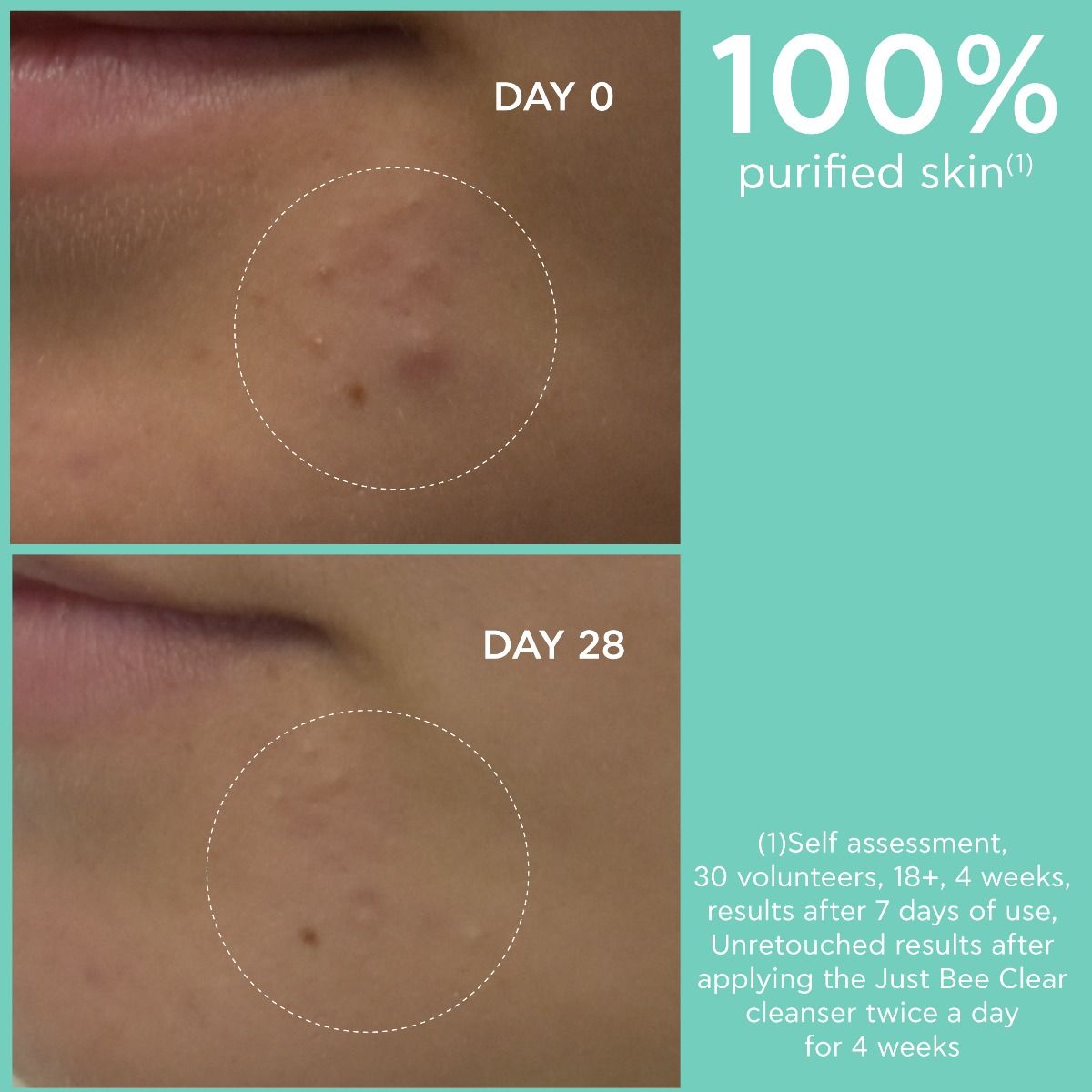 Purifying Cleanser Gel