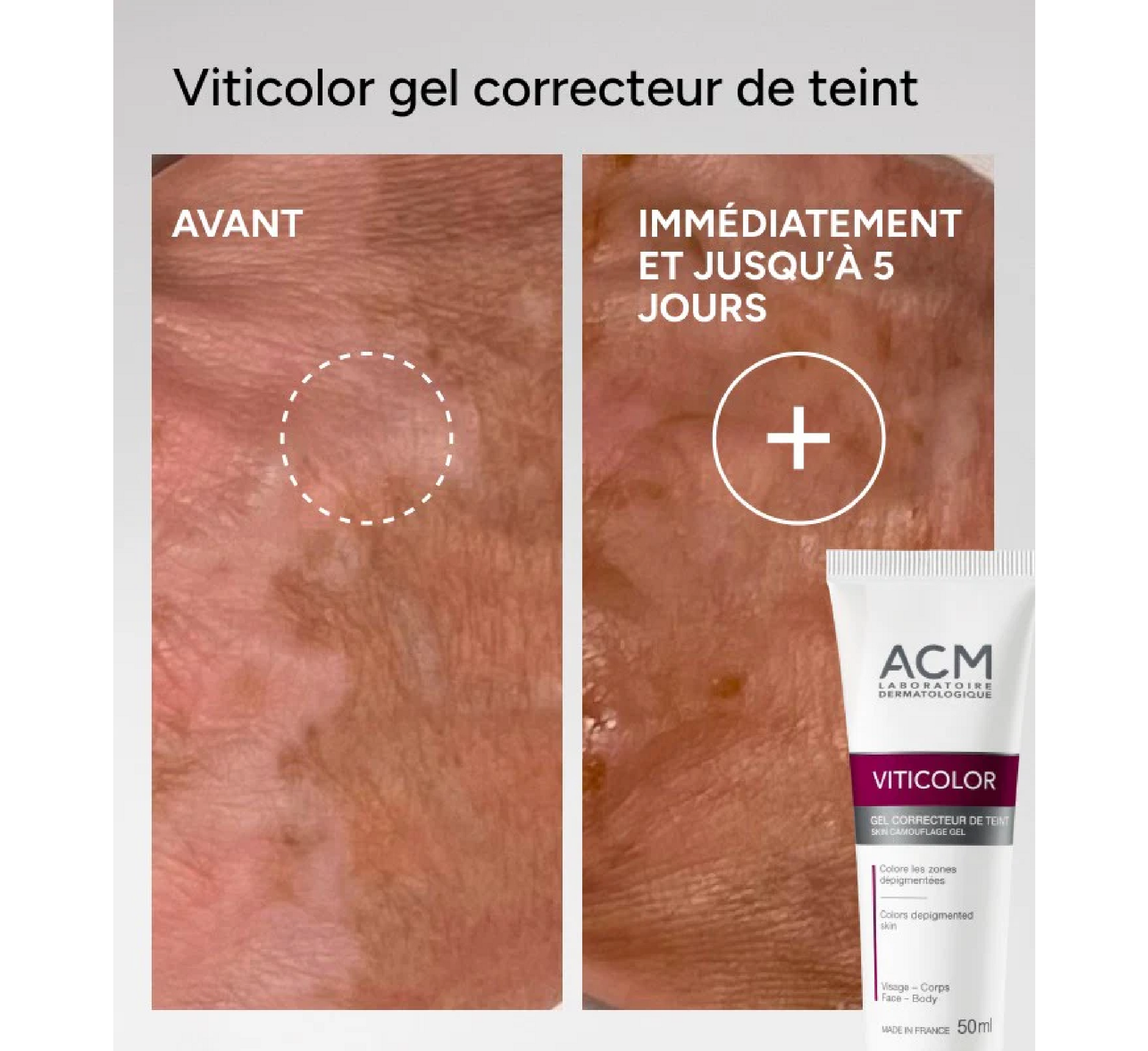 ACM Skin Camouflage Gel *50ml