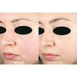 Active Microscrub