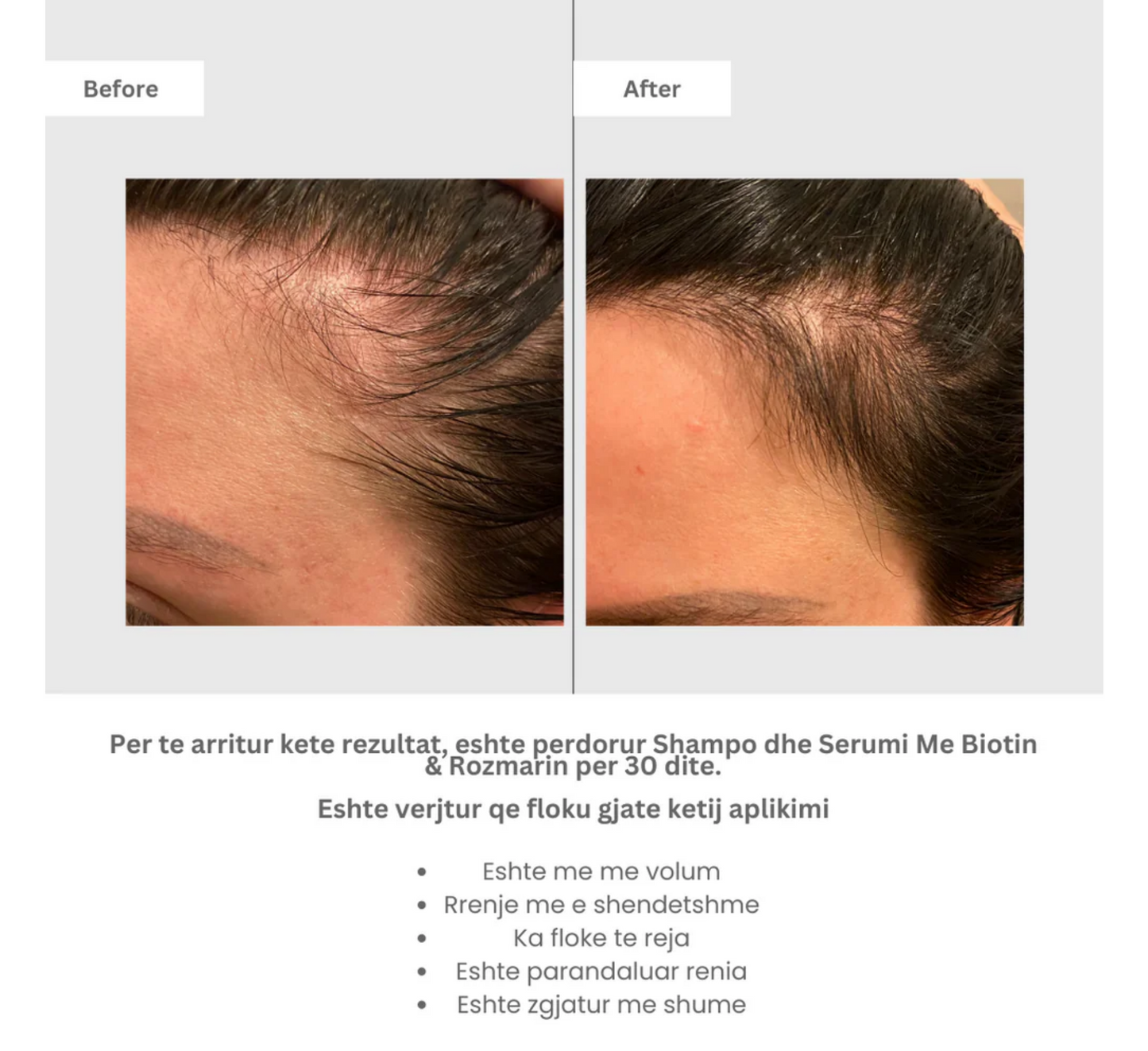 Serum Organik Alexandra me Biotinë dhe Rozmarinë *100ml