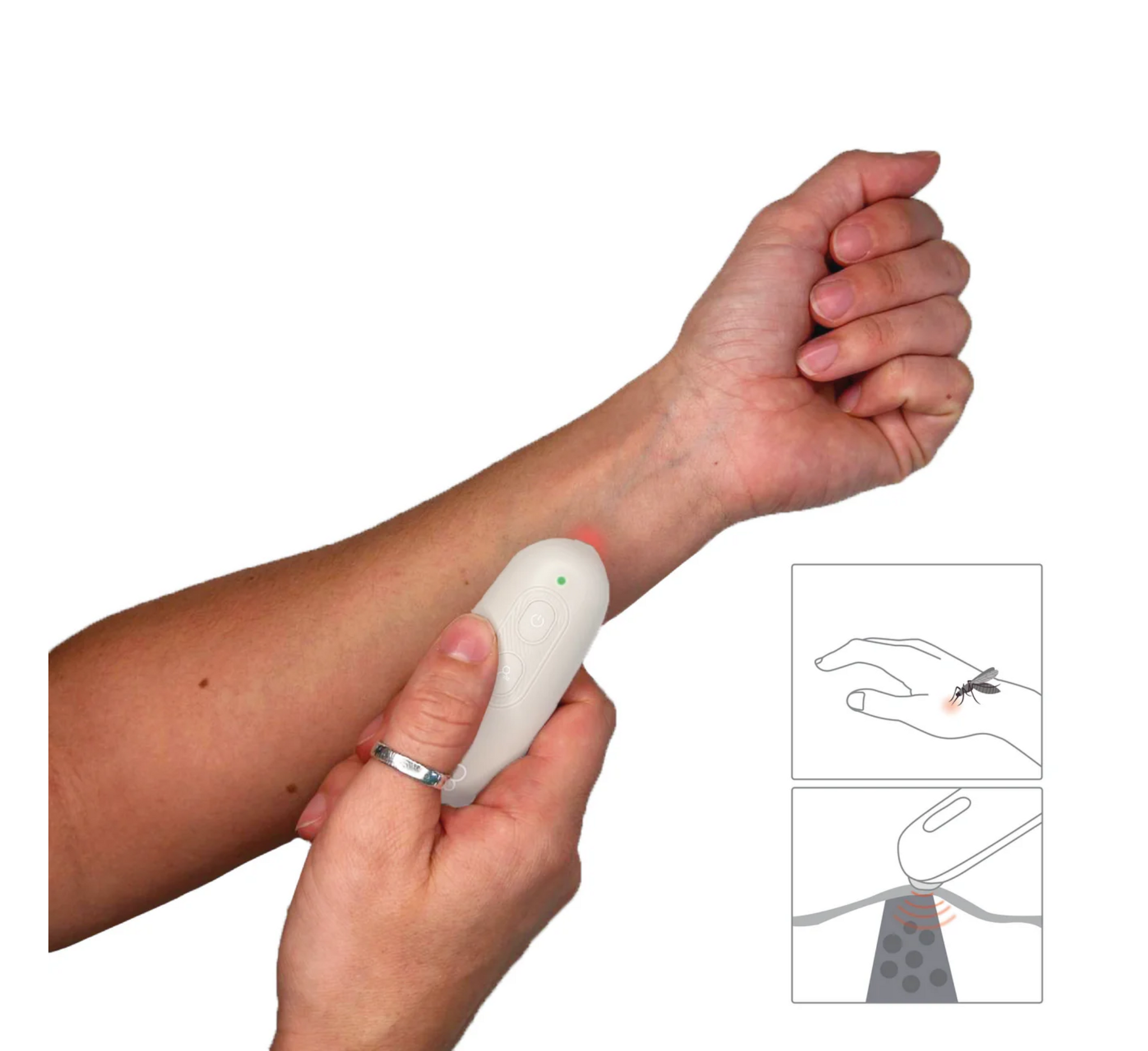 Bbluv Büg Insect Bite Relief Device