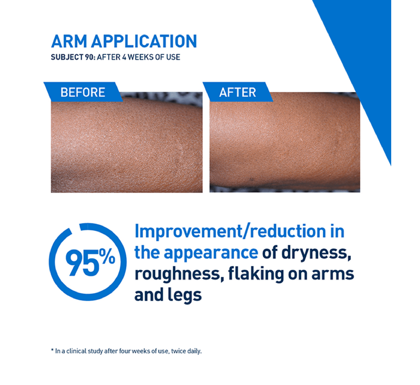 CeraVe Intensive Moisturising Lotion