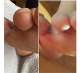 Shkumë Riparimi Feetcalm SOS 