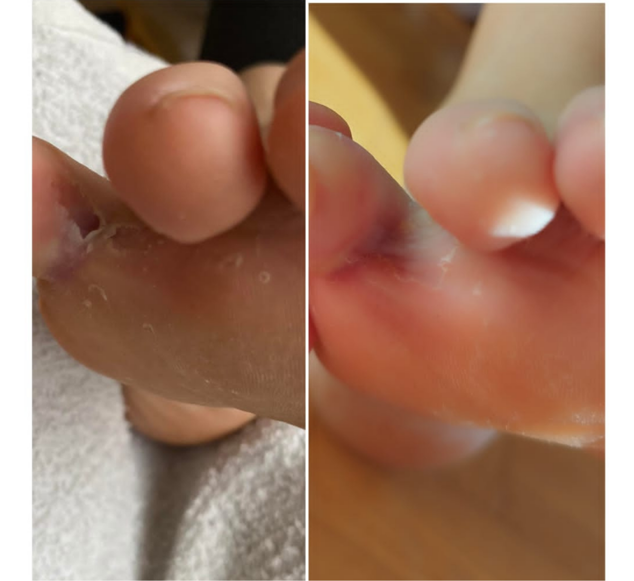 Shkumë Riparimi Feetcalm SOS 