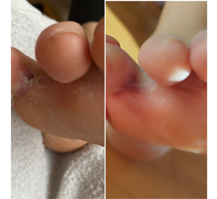 Feetcalm SOS Repair Mousse