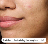 Hero Mighty Patch Duo *12 copë (6 Origjinale + 6 të Padukshme+)