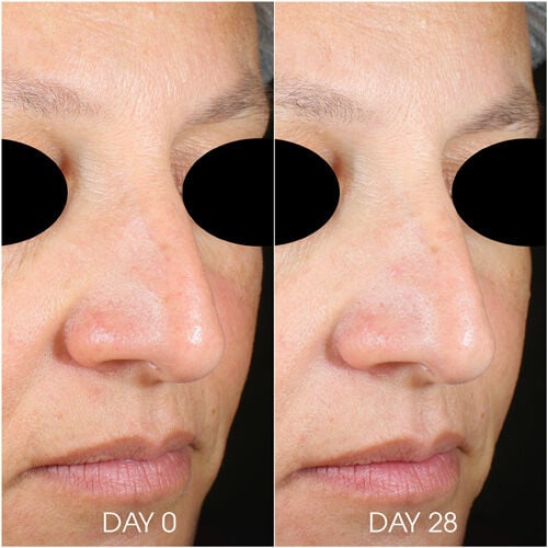 Teoxane RHA® Hydra Mask *50ml
