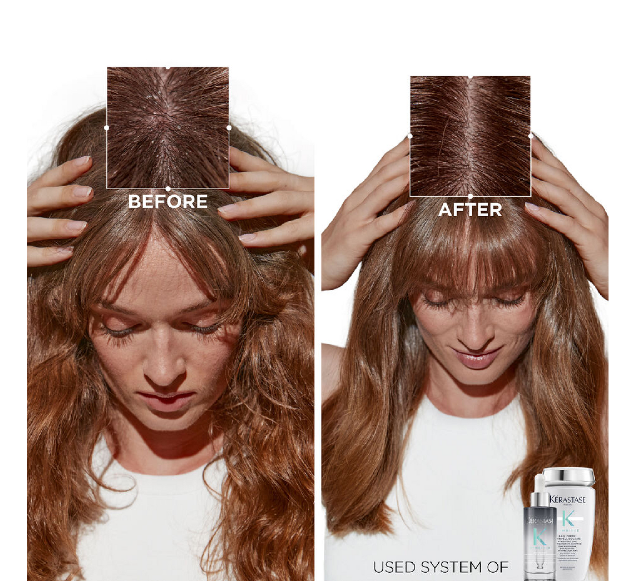 Serum nate kundër zbokthit Kérastase Symbiose *90ml