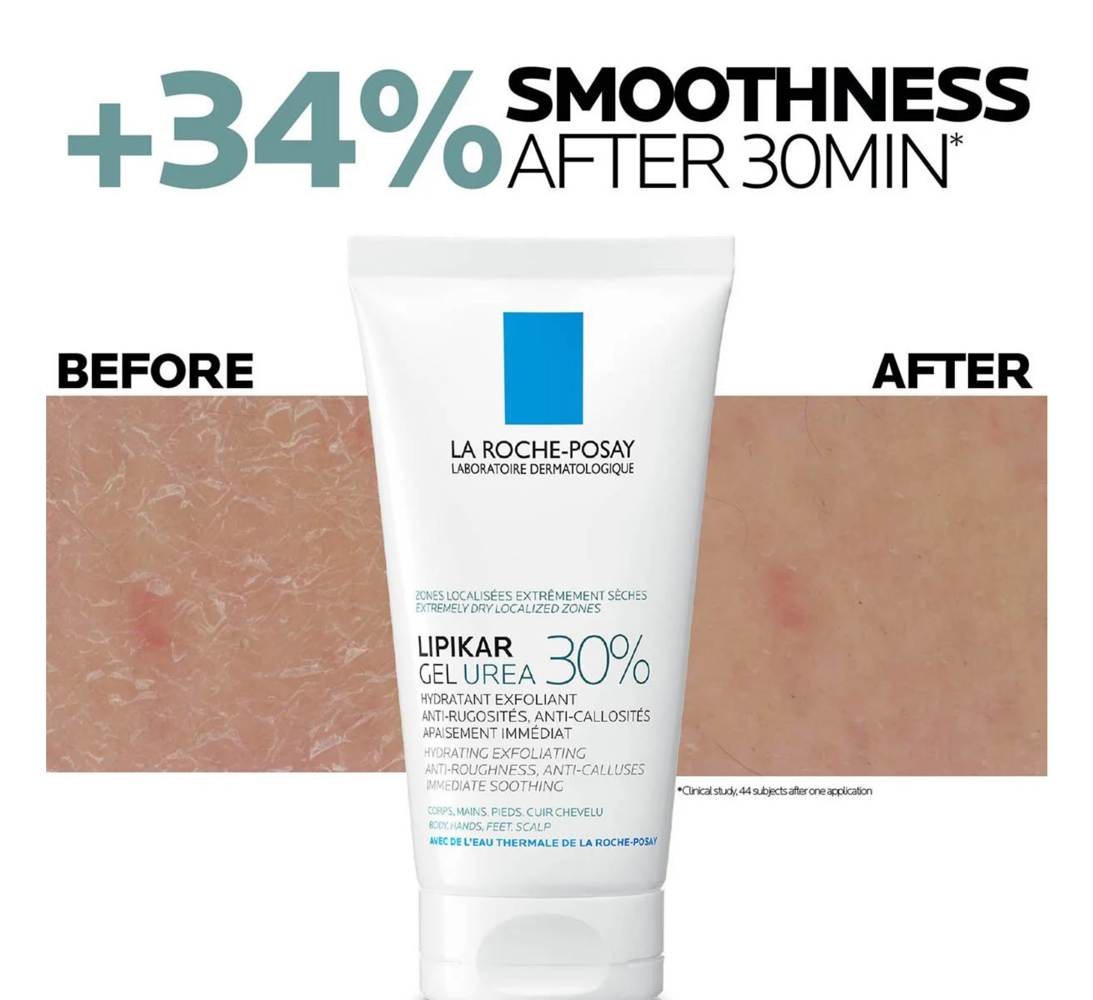 La Roche-Posay Lipikar Gel Urea 30% *50ml