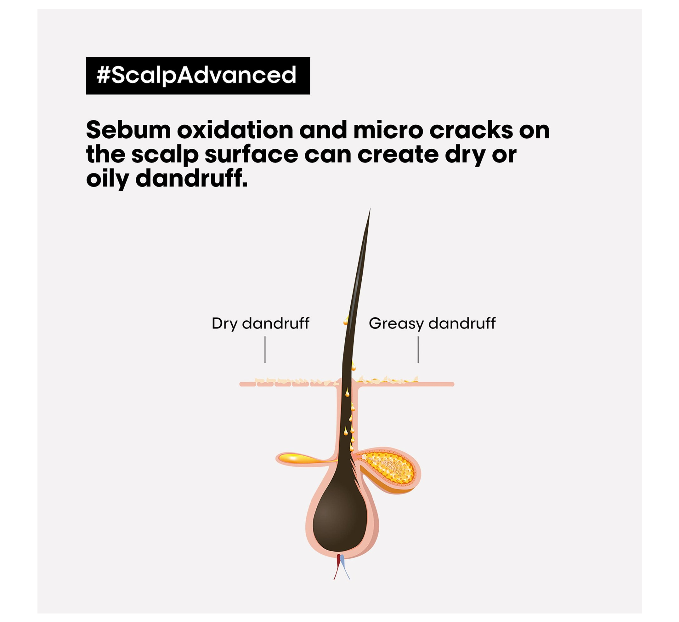 Loreal Professionel Scalp Advanced Anti-Dandruff Dermo-Clarifier Shampoo *300ml