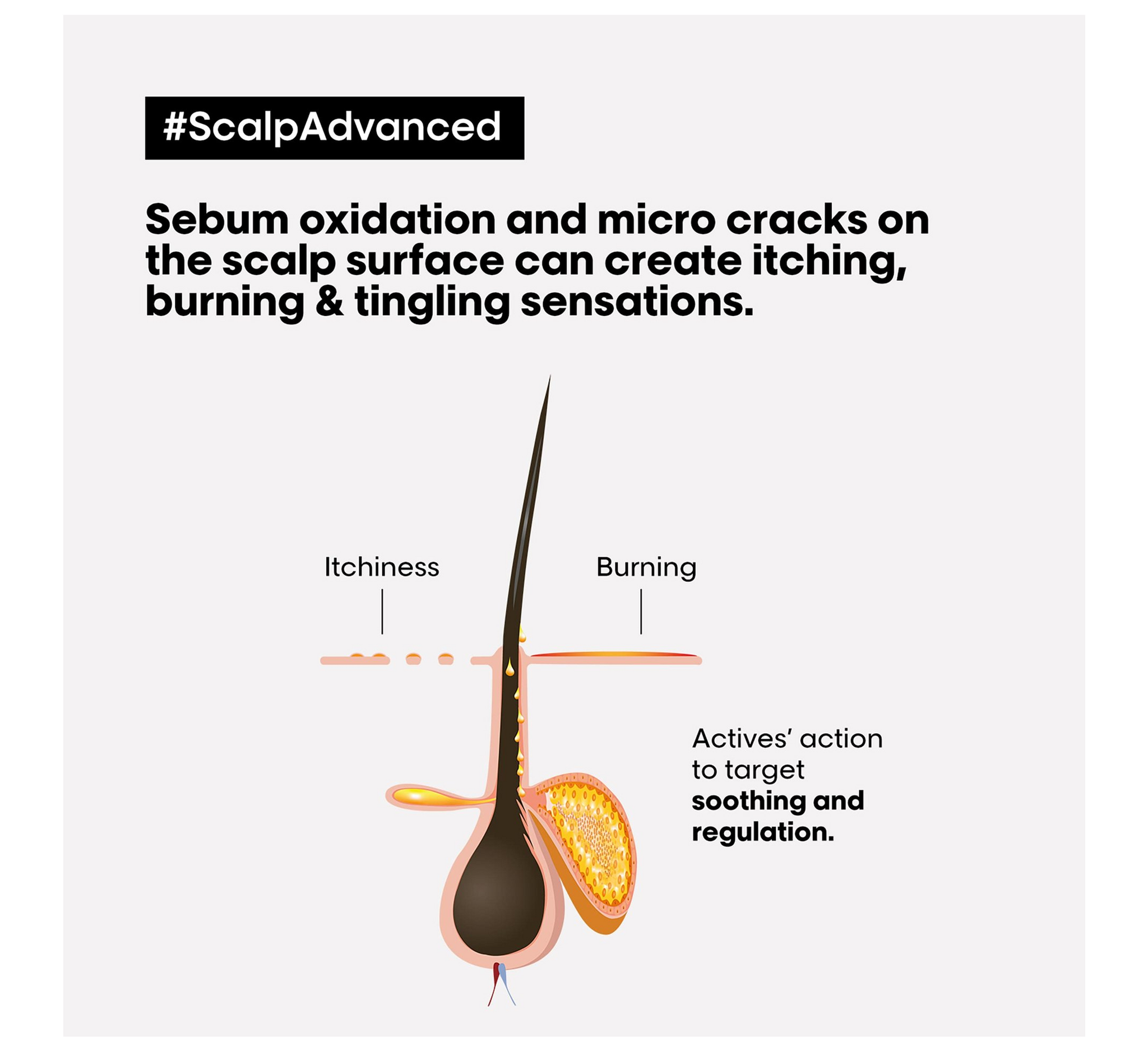 Loreal Professionel Scalp Advanced Anti-Discomfort Intense Soother Treatment *200ml