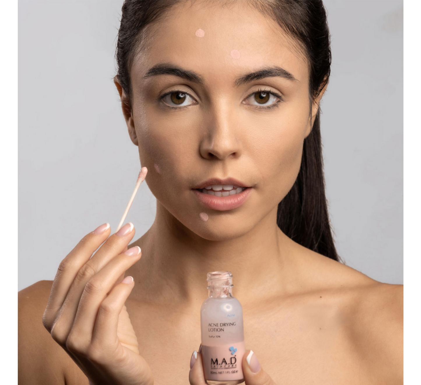Locion për tharjen e akneve MAD (Squfur 10%) *10ml