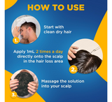 Tretësirë Minoxidil Topike USP 5% - Trajtim për Ri-rritjen e Flokëve për Burra (6x60ml)