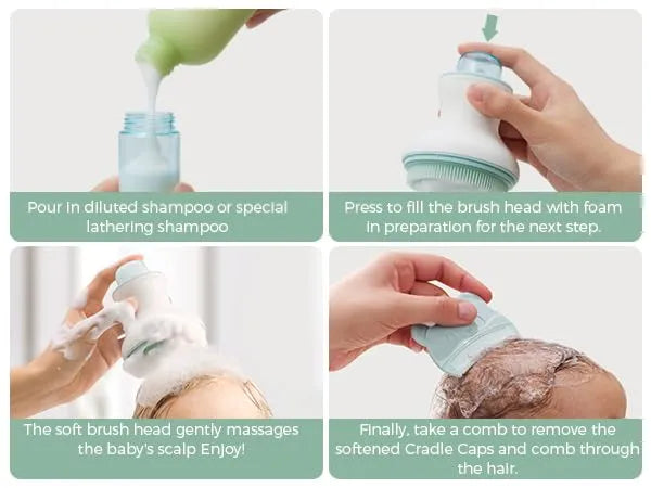 Momcozy﻿ Innovative Baby Cradle Cap Brush