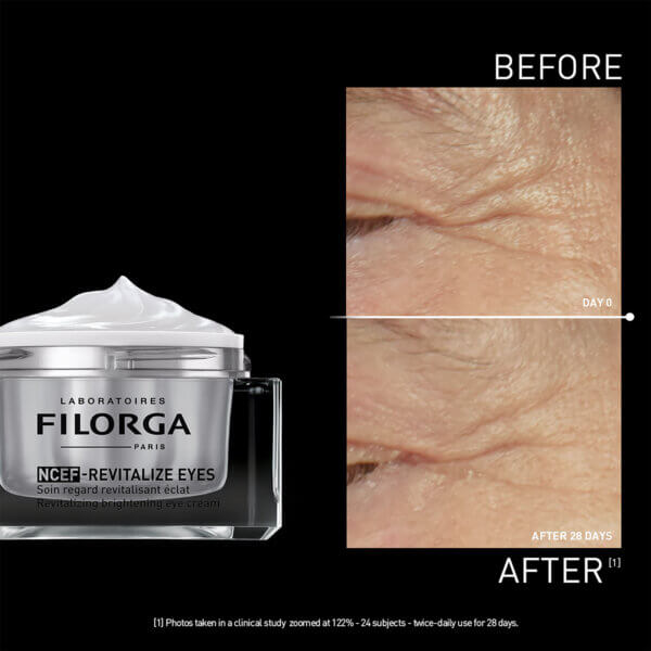 Filorga NCEF-REVITALIZE EYES - Brightening Eye Cream *15ml