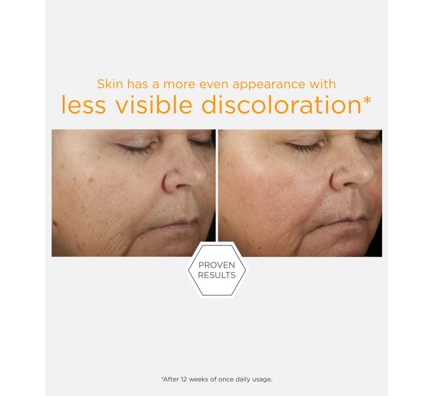 Serum NEOSTRATA Enlighten 15% Vitaminë C + PHA *15ml