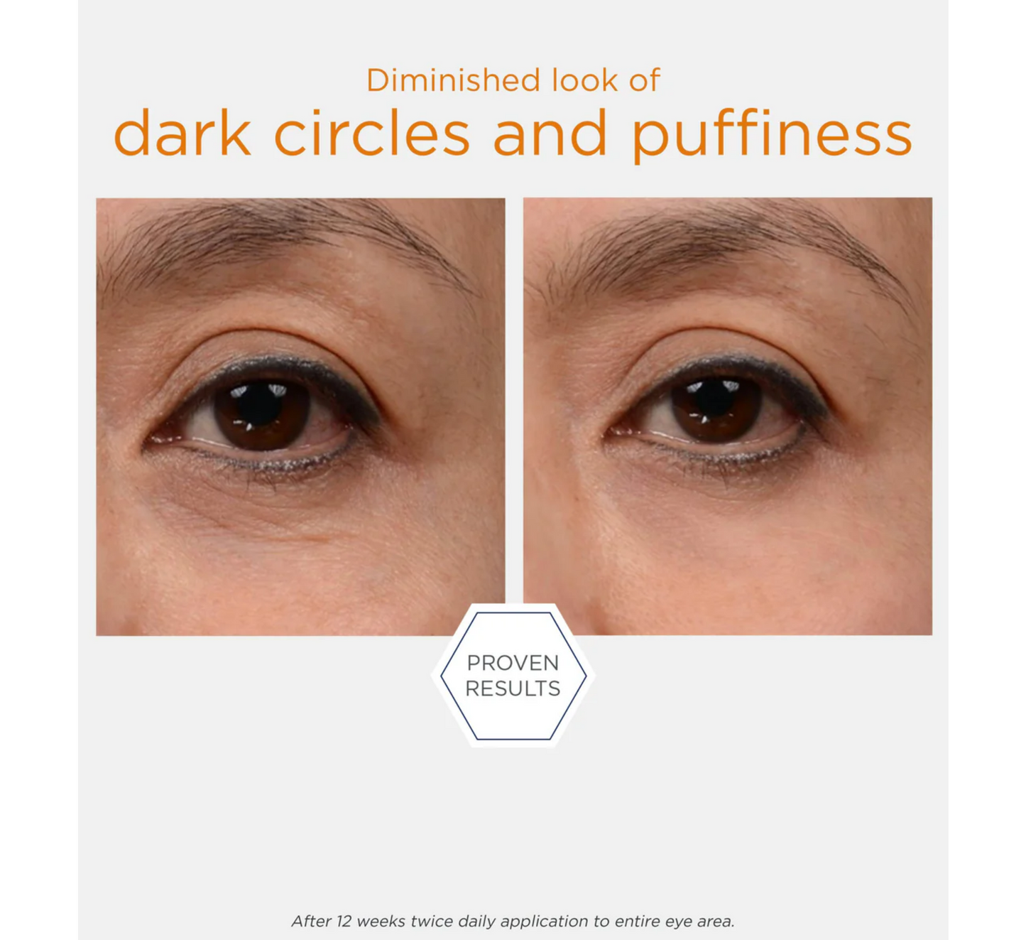 Krem për sytë NEOSTRATA Enlighten *15g