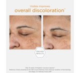 Serum ndriçues NEOSTRATA Enlighten *30ml