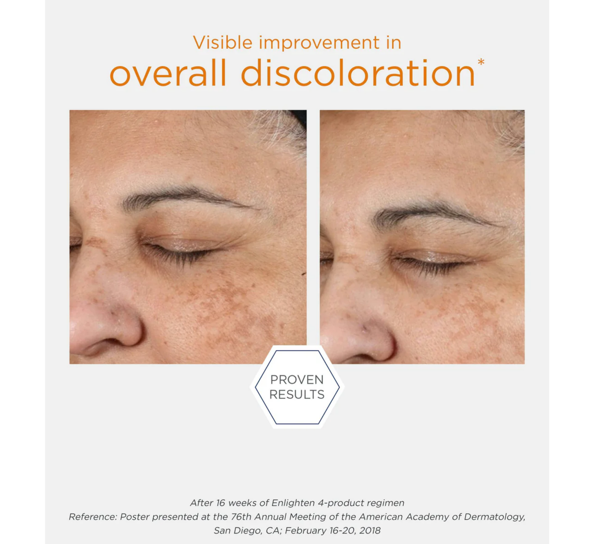 Kontrollues Pigmenti NEOSTRATA Enlighten *50ml