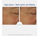 Kompleksi i fuqishëm i retinolit NEOSTRATA *30ml