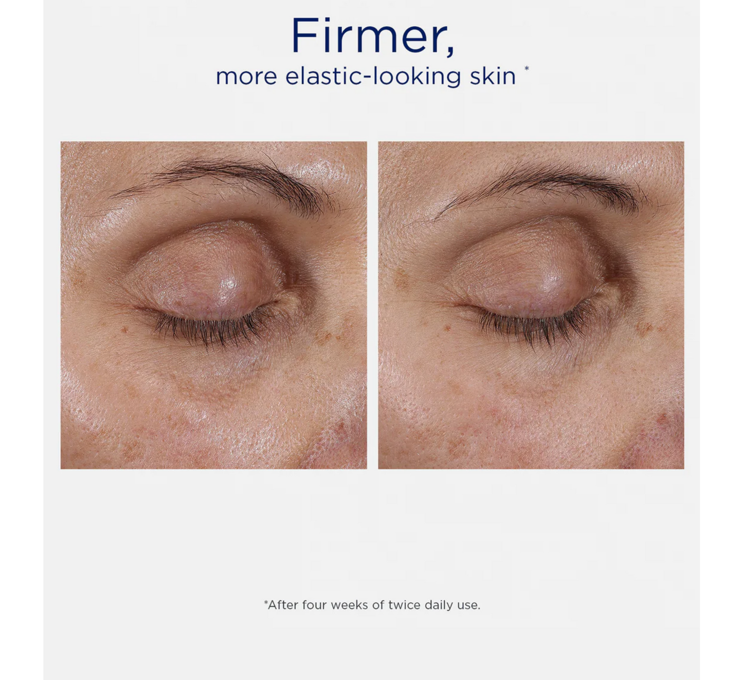 Terapi intensive për sytë NEOSTRATA *15g