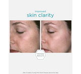 Pastrues për fytyrën NEOSTRATA Restore PHA *200ml