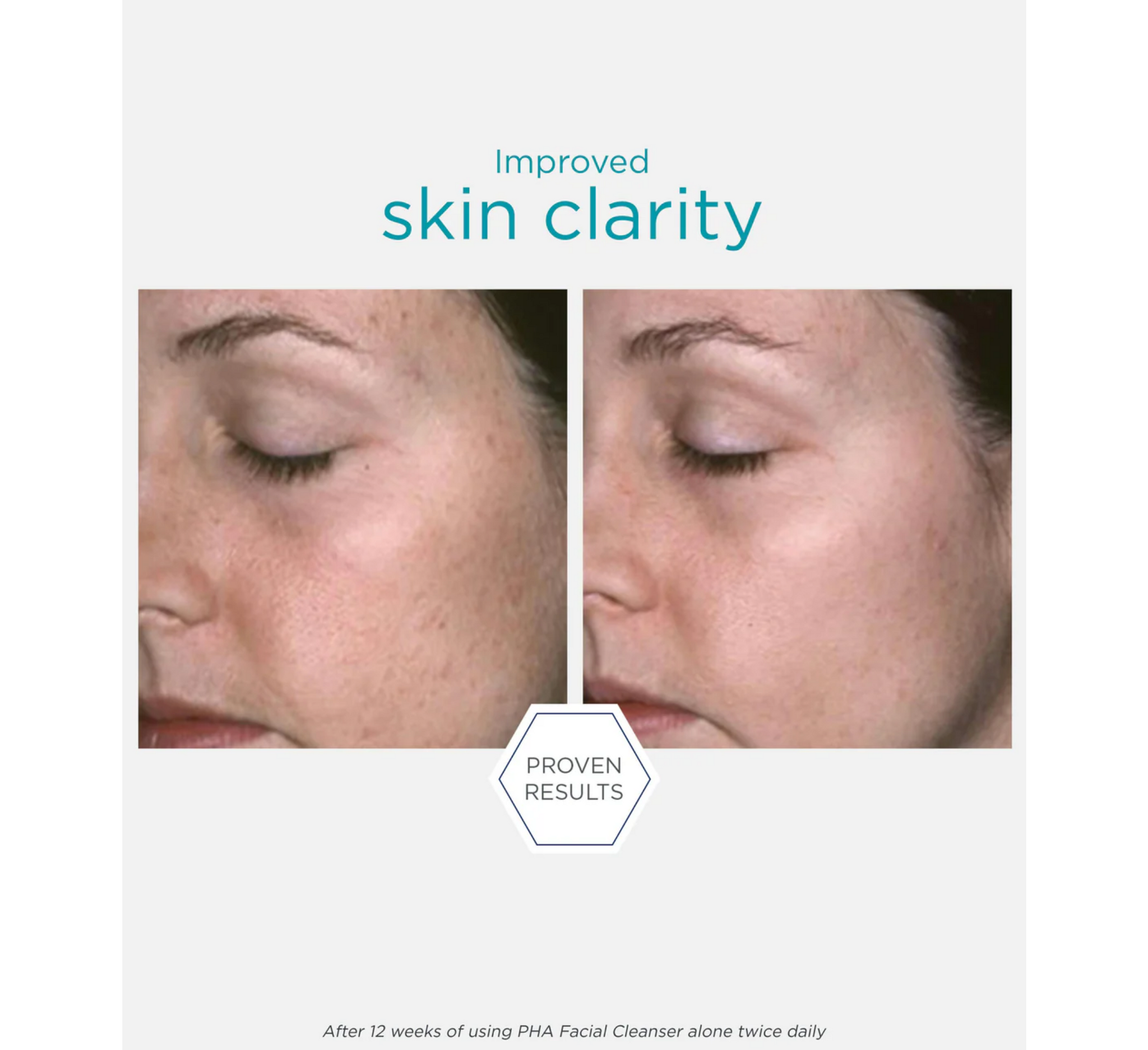 Pastrues për fytyrën NEOSTRATA Restore PHA *200ml