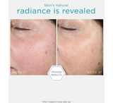 Disqe ripërtëritëse NEOSTRATA Restore PHA *60 copë