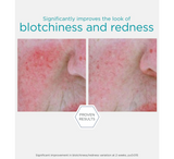 Serum Neutralizues për Rivendosjen e Skuqjes NEOSTRATA *29g