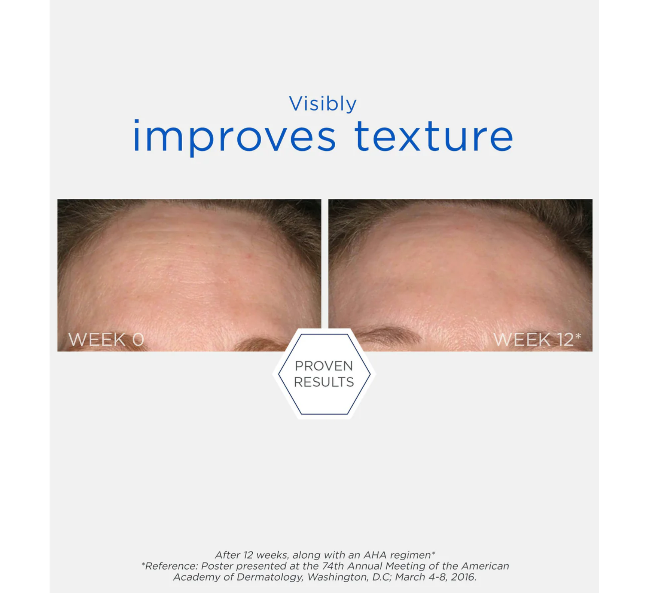 NEOSTRATA Resurface Smooth Surface Glycolic Chemical Peel *60ml
