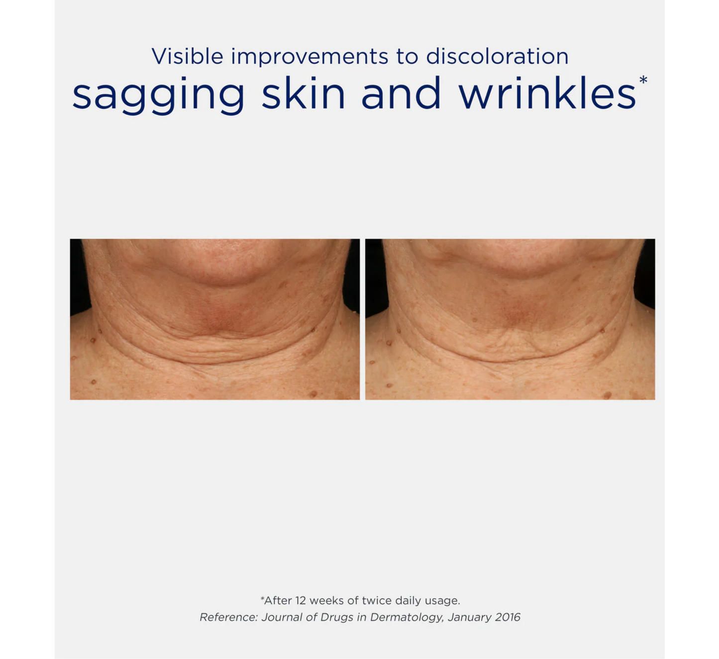 Krem trefish forcues për qafën NEOSTRATA me MicroDiPeptide229® *80g