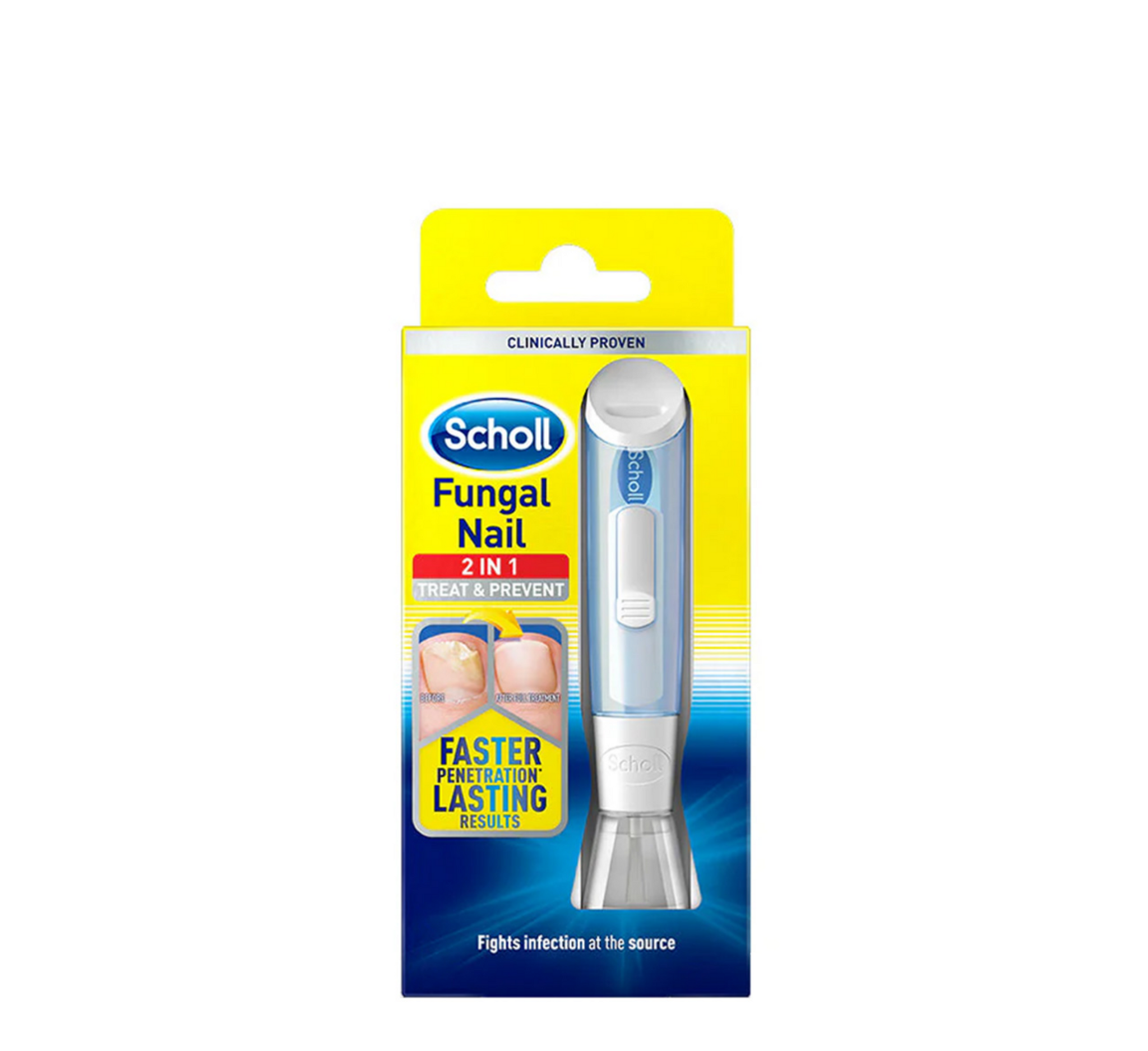 Scholl Trajtim dhe Parandalim i Thonjve Kërpudhash 2 në 1