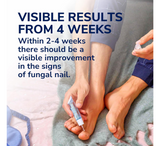 Scholl Trajtim dhe Parandalim i Thonjve Kërpudhash 2 në 1