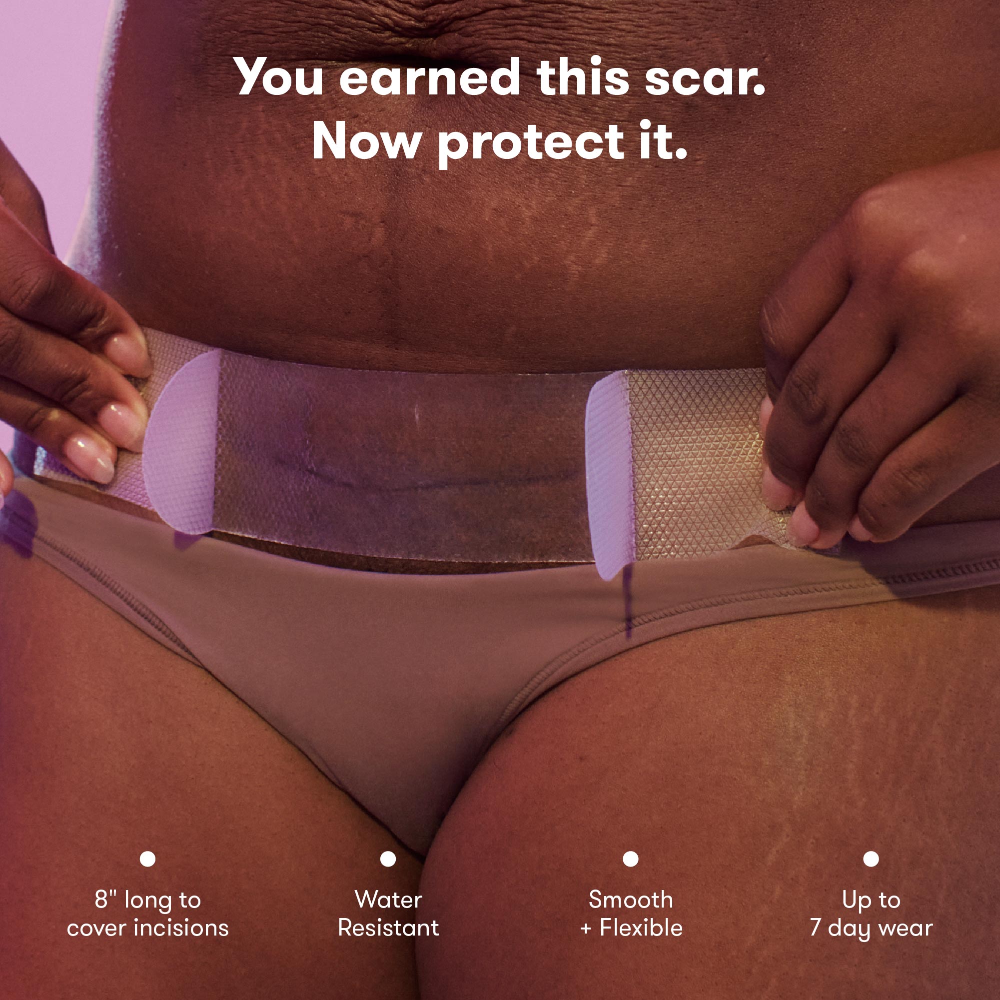 C-Section Silicone Scar Patches