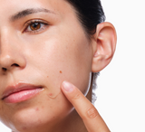 The Ordinary - Seti i Akneve 