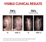 Vichy Dercos Aminexil Regen Booster Hair Renewing Serum *90ml