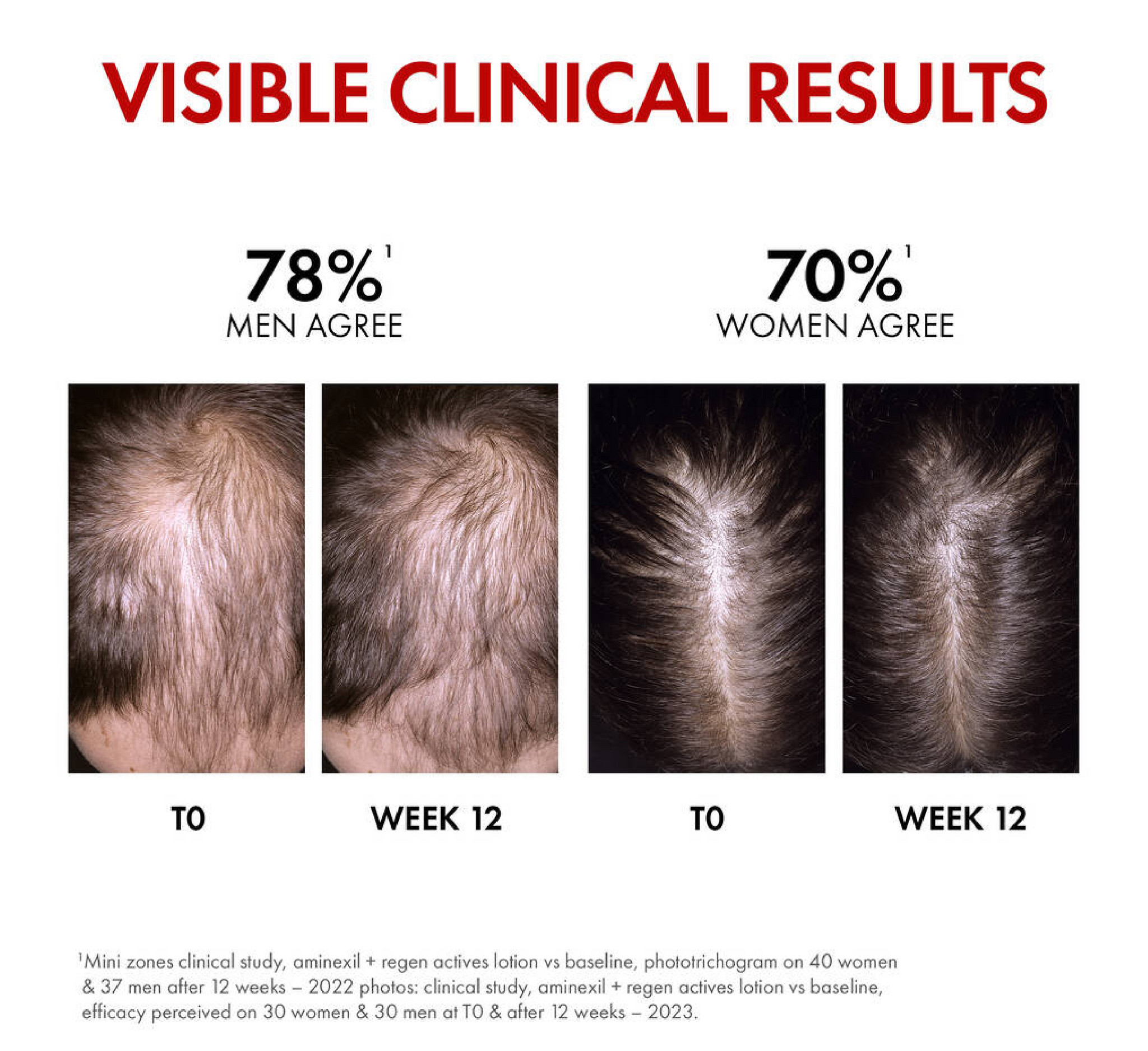 Vichy Dercos Aminexil Regen Booster Hair Renewing Serum *90ml