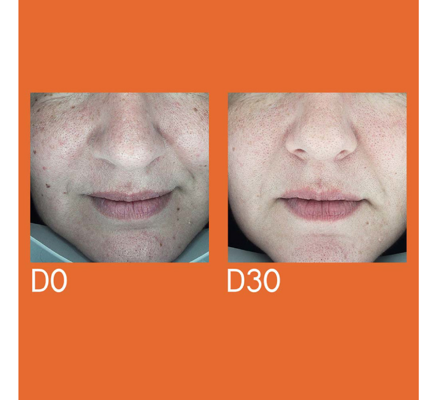 Serum për heqjen e njollave të errëta Youth Lab *30ml 