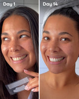 Whitening Strips - Mint