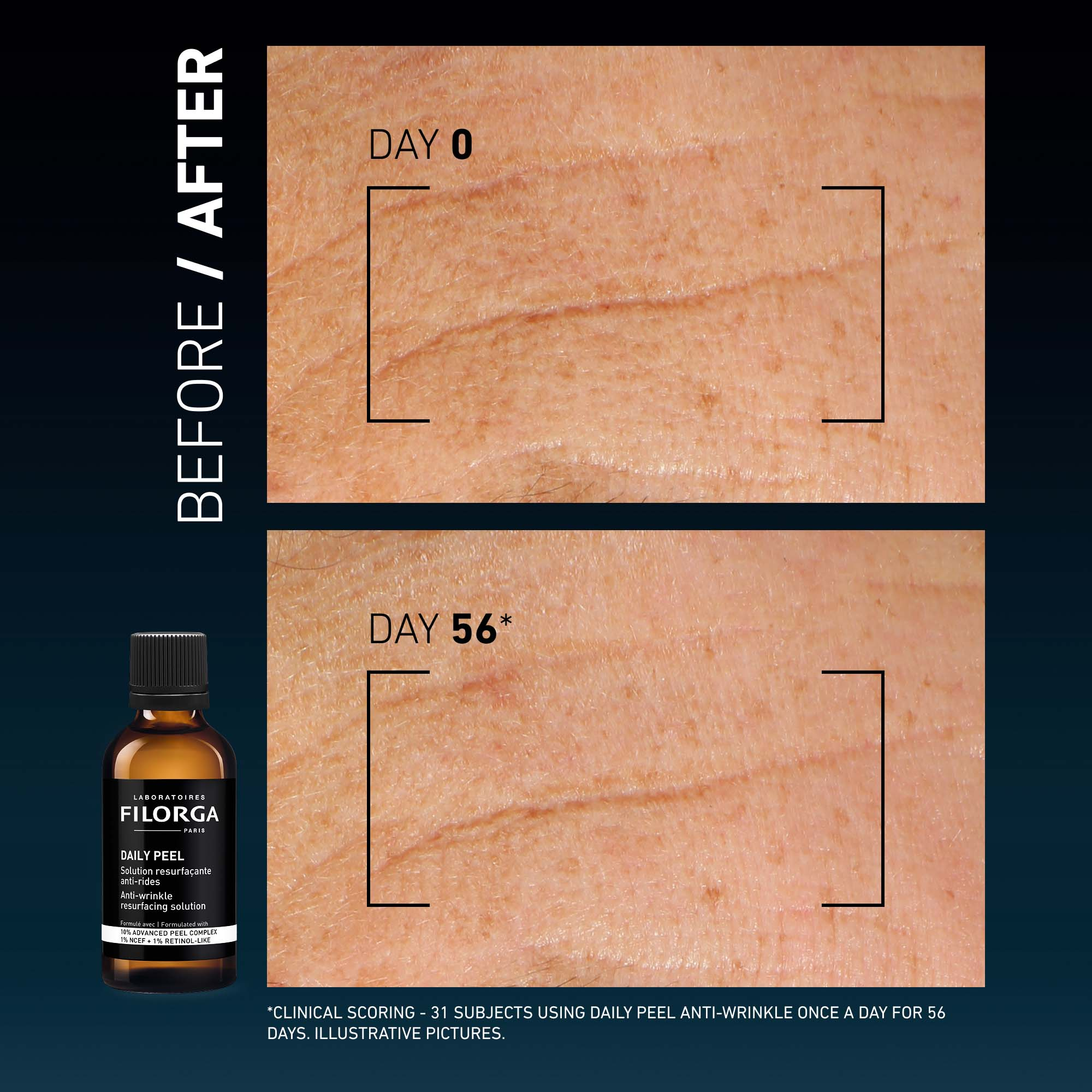 DAILY PEEL – WRINKLES