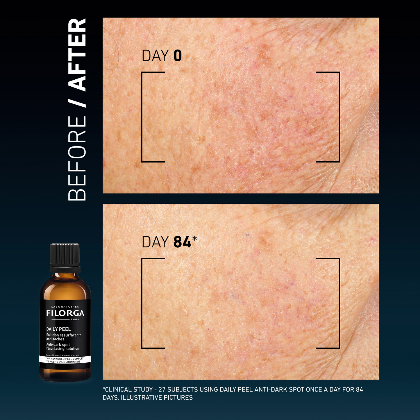 DAILY PEEL – DARK SPOTS