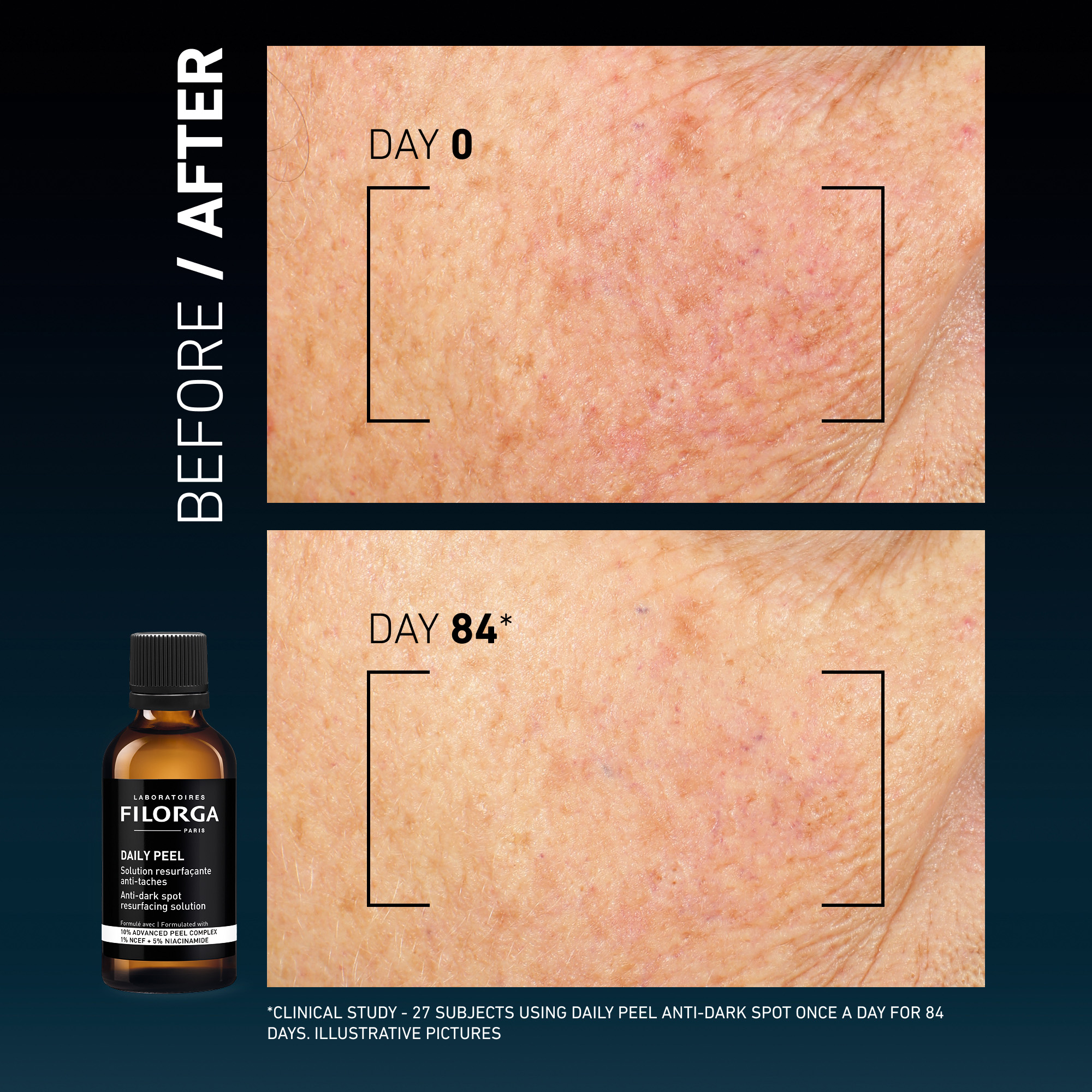 DAILY PEEL – DARK SPOTS