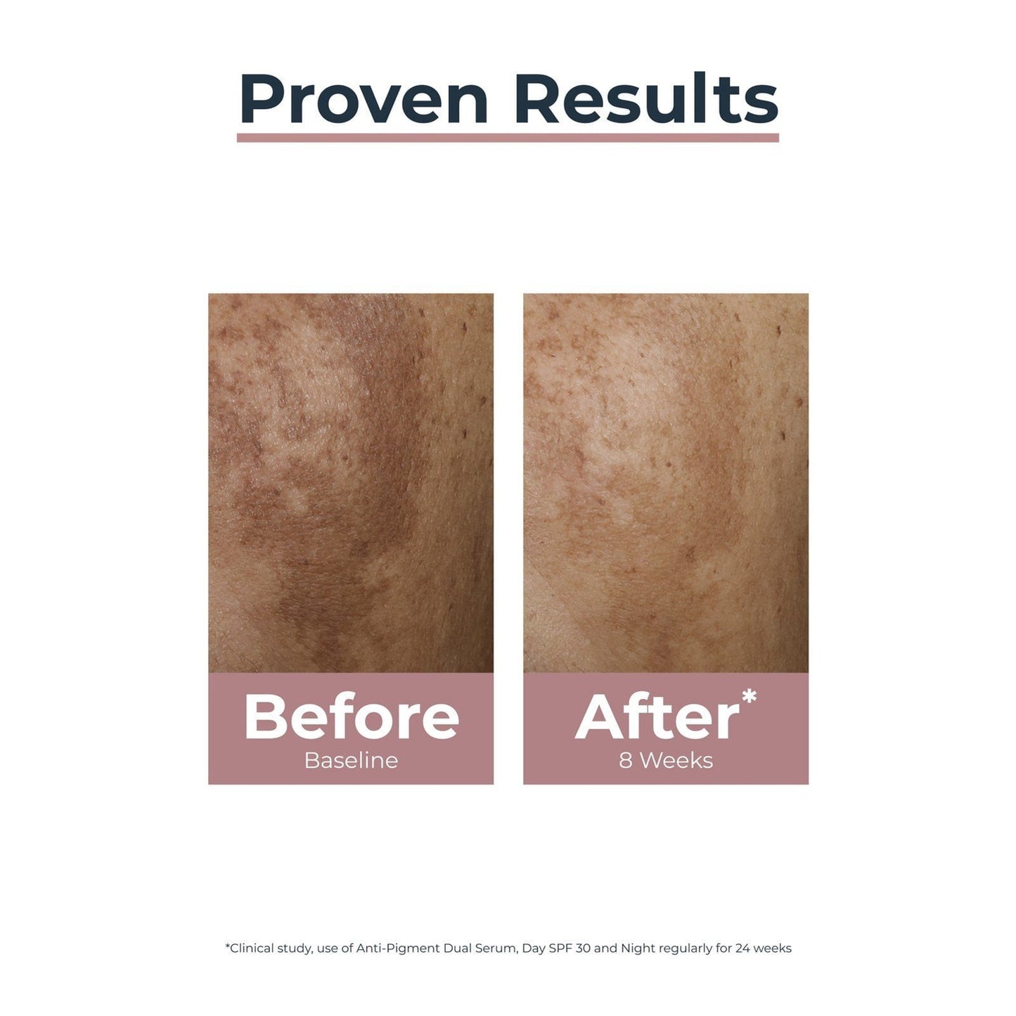 Eucerin Anti-Pigment Night Care Dark Spots 50ml