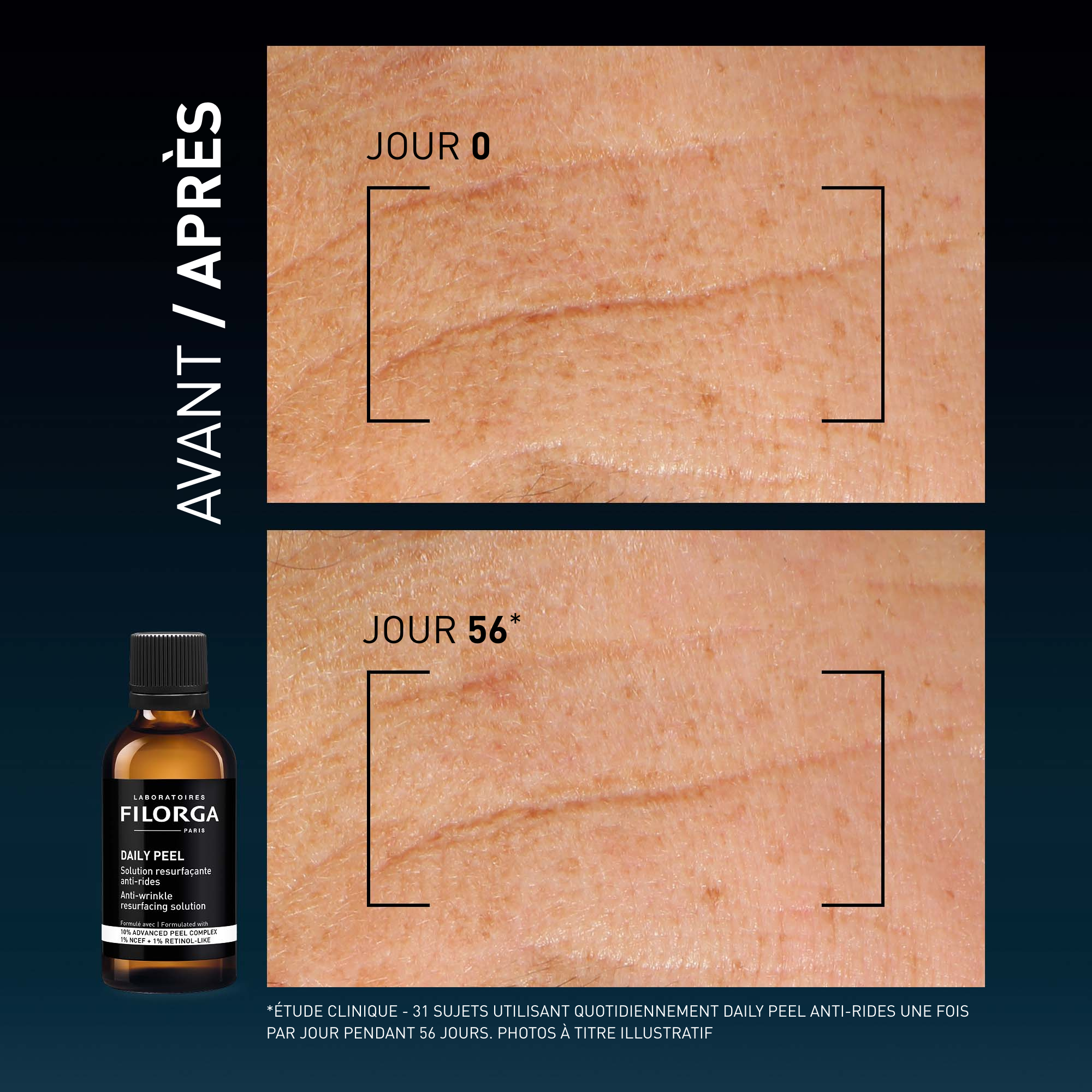 DAILY PEEL – WRINKLES