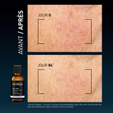 DAILY PEEL – DARK SPOTS