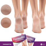 Parasoftin carape - Halsa