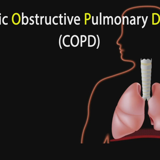 NL100 Piston Nebulizer