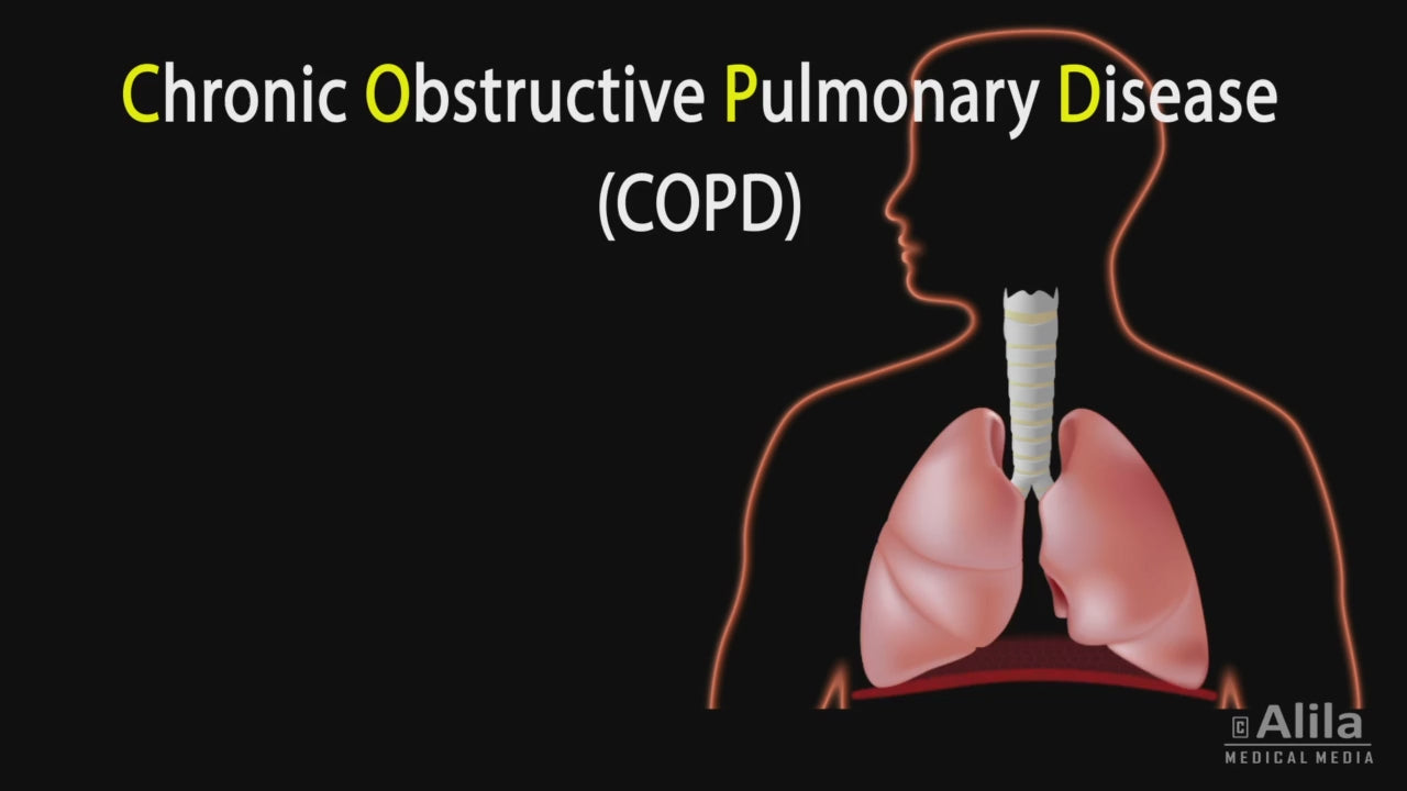 NL100 Piston Nebulizer